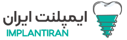 کلینیک ایمپلنت دندان ایران،ایمپلنت دندان اقساطی،ایمپلنت دیجیتال،ایمپلنت فروی در تهران